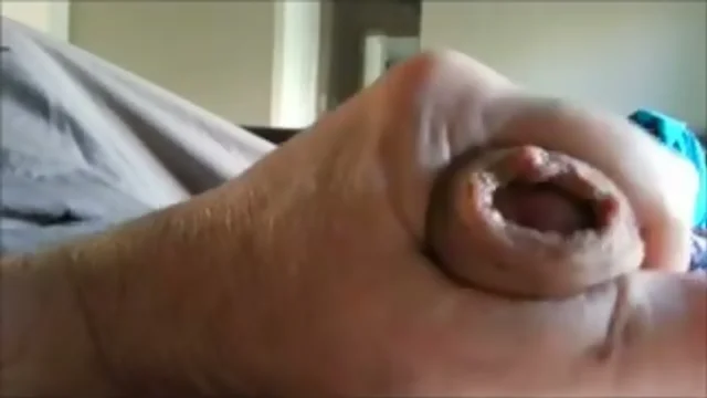 Finger docking with foreskin