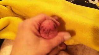 Playing with my Scarred-Up Penis: Torture for Pleasure