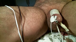 Electrostimulation using short urethral probe
