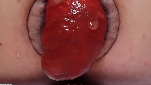 Unparalleled Anal Prolapse HD Videos: Up Close and Personal