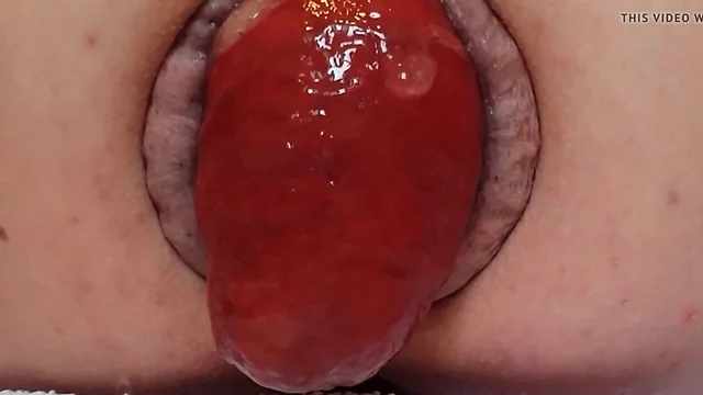 Unparalleled Anal Prolapse HD Videos: Up Close and Personal