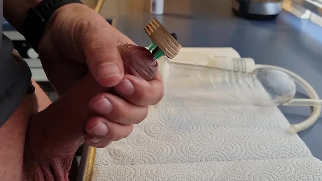 Inserting two needles with a vakuum pump into the glans