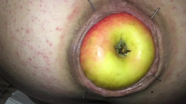 Removing an apple stuck in a pigs backside