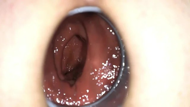 Extreme anal insertions: the mastdarm experience